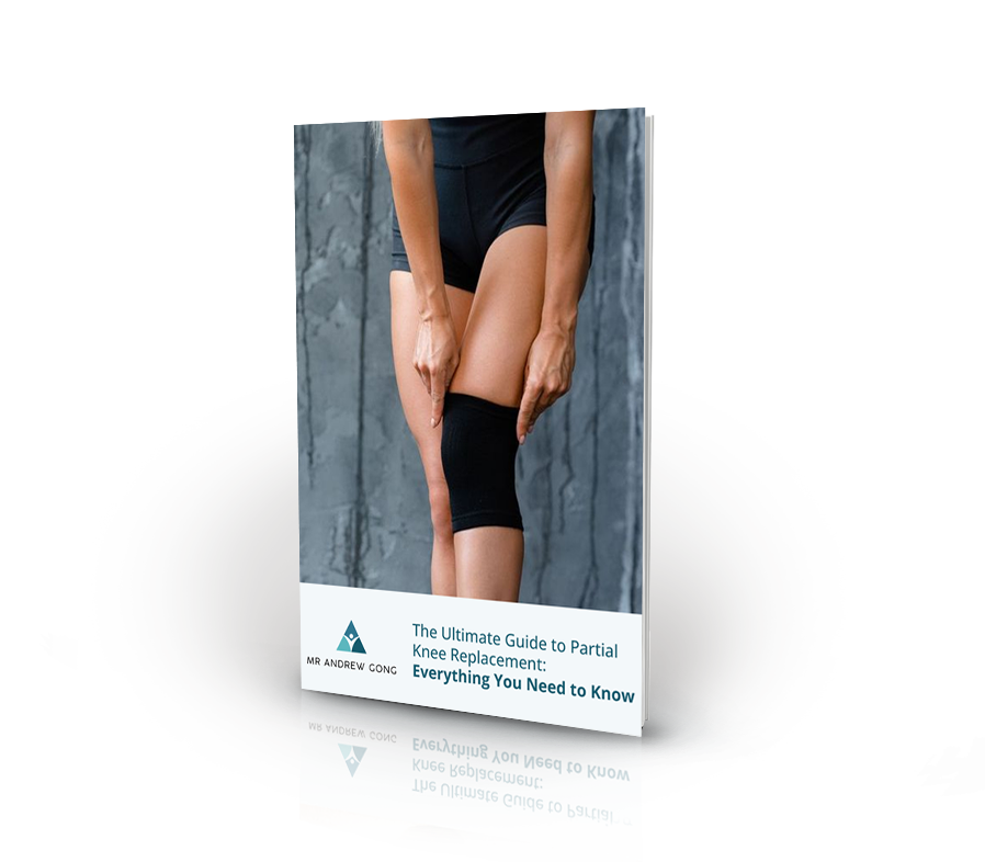 book cover for The Ultimate Guide to Partial Knee Replacement